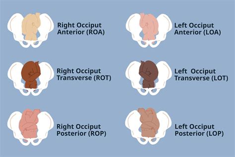 Fetal Positions For Labor And Birth