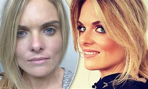 Erin Molan Shows Her Face With And Without Makeup Glam Squad Without