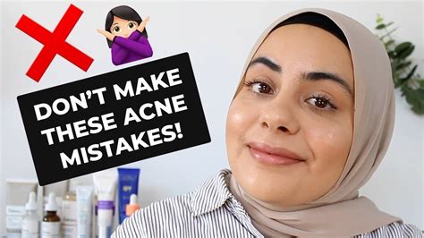 Common Acne Mistakes 5 Ways You Are Making Your Acne Worse Youtube