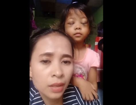 Viral Ibu Tunjukkan Mata Anak Bengkak Usai Main Handphone Warganet