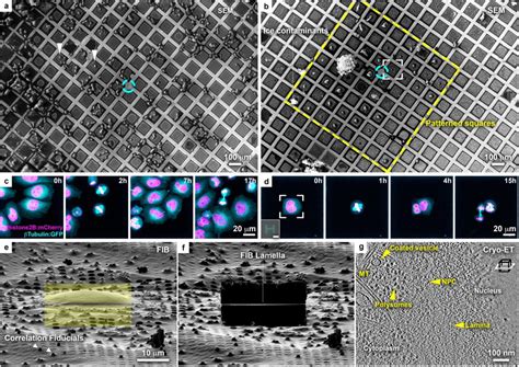 Tailoring Cryo Electron Microscopy Grids By Photo Micropatterning For