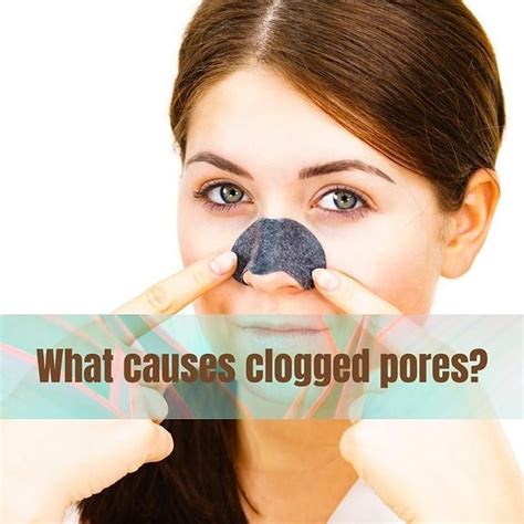 Your Ultimate Guide To Prevent Clogged Pores 💙 In 2022 Clogged Pores