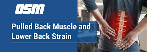 Pulled Back Muscle And Lower Back Strain Orthopedic And Sports Medicine