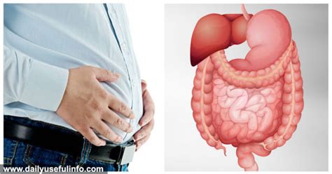 8 Causes Of Bloated Stomach And Natural Remedies Health And Safety