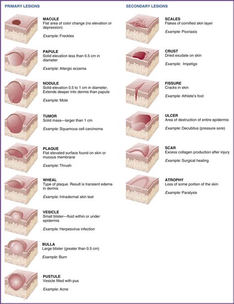 Primary Skin Lesions Chart