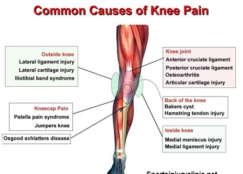 What Causes Posterior Knee Pain Margaret Greene Kapsels