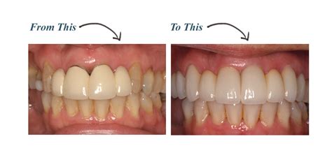 Attleboro family dental care is your hometown dental practice. Affordable Dentist Houston Tx | Affordable Dental Near Me ...