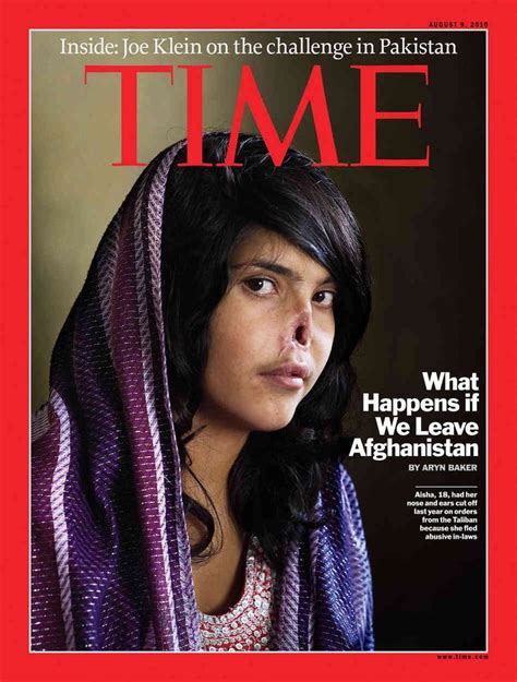 Bibi Aisha Disfigured Afghan Woman Featured On Time Cover Visits U