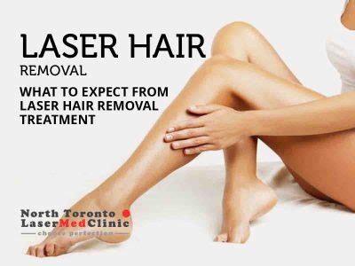 Laser Hair Removal Toronto North Toronto Laser Med Clinic