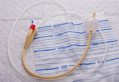 A Urinary Catheter Bulb