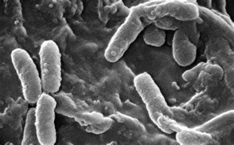 Pseudomonas Aeruginosa Meets The Plant Root The Microbial Menagerie