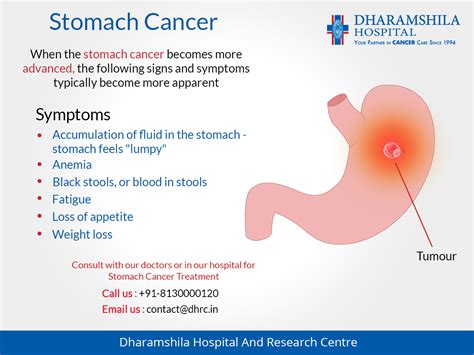 Early Warning Signs Stomach Cancer