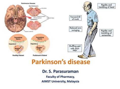 Parkinsons Disease Ppt