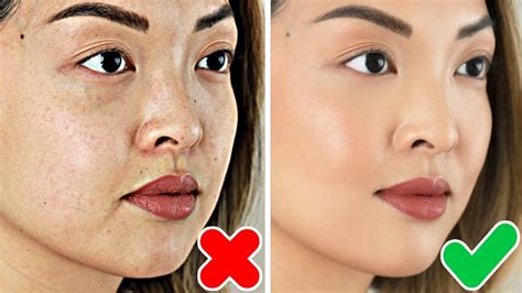 How To Get Rid Of Hyperpigmentation And Dark Spots Fast Youtube