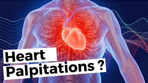 How To Approach A Patient With Heart Palpitations Differential