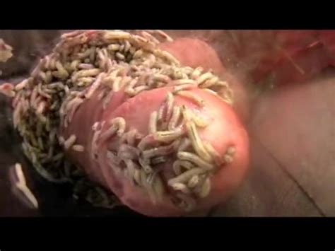 Maggots In Cock Video 3