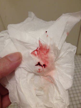 Whattoexpect.com points out that commonly, mucus discharge that is pink or brown and often stringy can result. 7 wks- bleeding w/ stringy clot. Pic included - BabyCenter