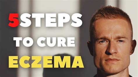 5 Steps To Cure Eczema Youtube