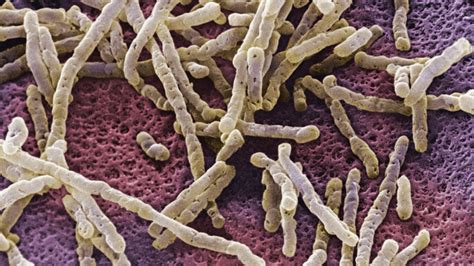 Bezlotoxumab For Recurrent C Difficile Infections Microbiology