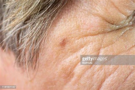 Age Spots Face Photos And Premium High Res Pictures Getty Images