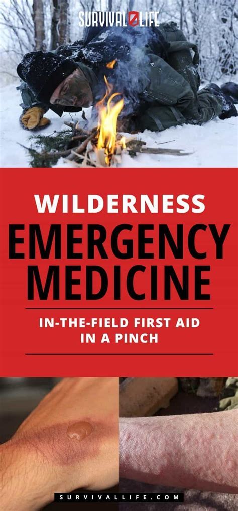 Wilderness Emergency Medicine With Images Emergency Medicine First