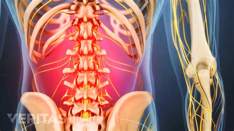 Lower Right Back Pain Tissues And Spinal Structures