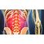 Lower Right Back Pain Tissues & Spinal Structures
