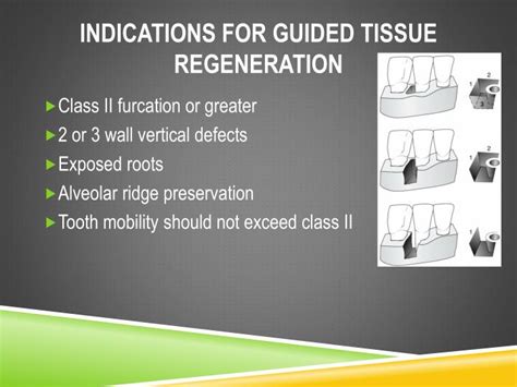 Ppt Guided Tissue Regeneration Powerpoint Presentation