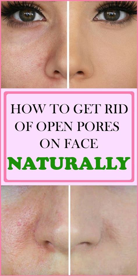 how to get rid of open pores on face naturally open pores on face oily skin acne best skin