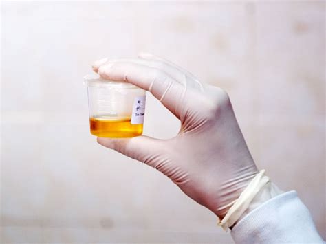 During pregnancy, due to the increased renal blood flow, some additional protein may be lost in the urine. 24-hour Urine Protein Test: Purpose, Procedure, and Results