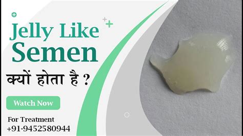 What Does Thick Jelly Sperm Mean Or Is Clumpy Sperm Healthy By Dr Nizamuddin Qasmi Youtube