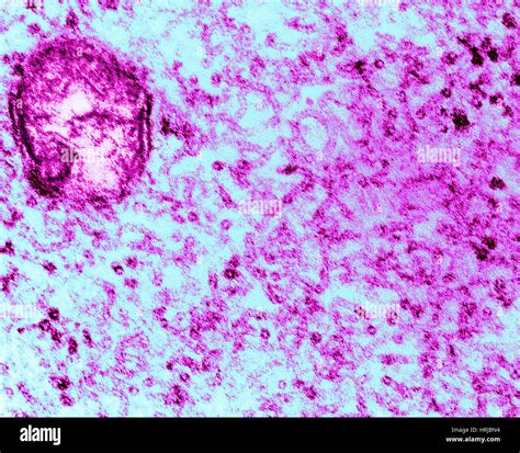 Mumps Virus Tem Stock Photo Alamy