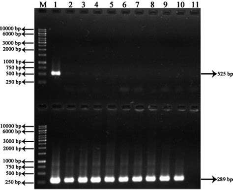 Nested Pcr Based Detection Of Human Leptospirosis M 1kb Molecular