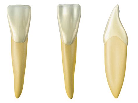 Mandibular Central Incisor Tooth In The Buccal Palatal And ...