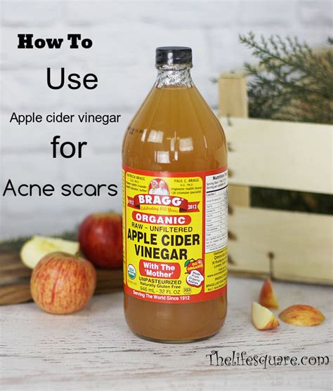 Apple cider vinegar has shown promise in blood sugar and cholesterol control, weight loss, detox, heart disease and even cancer. Why And How To Use Apple Cider Vinegar To Cure Acne Scars