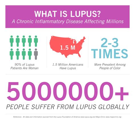 Curascript Sd Get To Know Lupus Infographic