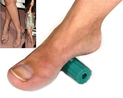20 Photos That Will Make You Squirm If You Think Feet Are Weird Weird