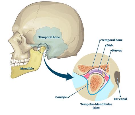 Jaw Pain Neck Pain Headaches Mpls Health And Wellness Ne