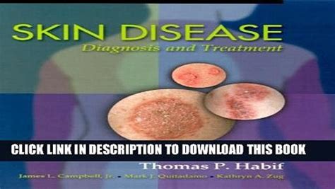 Pdf Skin Disease Diagnosis And Treatment Full Online Video Dailymotion