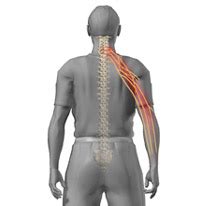 Leziunile coloanei vertebrale cervicale sunt rezultatul actiunii fortelor indirecte care actioneaza la nivelul capului si gatului. Zervikale Spinalkanalstenose