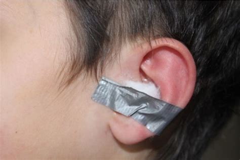 He Duct Taped A Cotton Ball Inside His Ear And Left It There Overnight