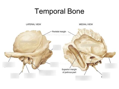 HESP Exam Temporal Bone Anatomy And Pathology Diagram Quizlet