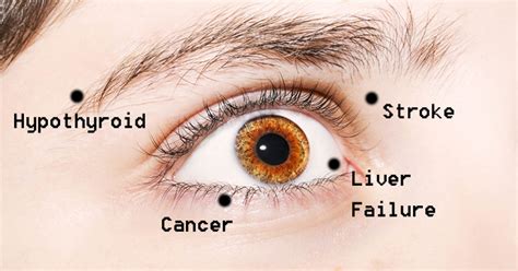 8 Eye Problems That May Actually Indicate Disease