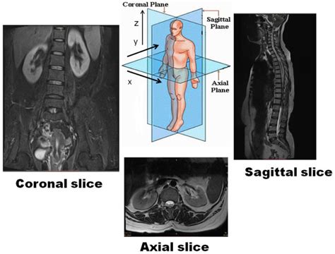 3d Reconstruction Of Spine Image From 2d Mri Slices Along One Axis