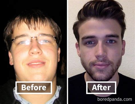How To Slim Down Your Face And Improve Your Jawline Justinboey