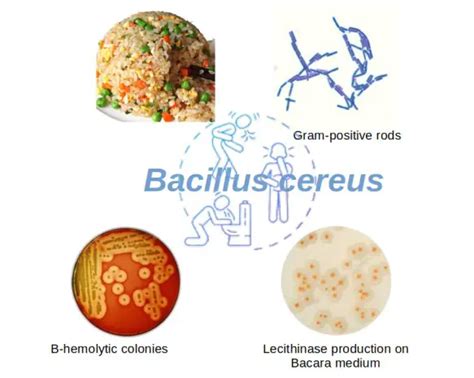Bacillus Cereus Morphology Disease Biochemical Tests Microbe Online