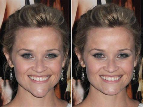 Cosmetic Surgery Connoisseur Reese Witherspoon With A More Normal Chin