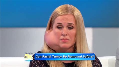 Large Facial Tumor Removal Parotid Gland The Doctors Tv Show Youtube