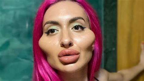 Insta Model With The Biggest Cheeks In The World Claims Theyre Still Too Small Herald Sun