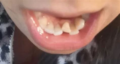 9 Chicklets Teeth Gwennanclaire